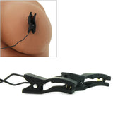 Fetish Fantasy Shock Therapy Kinky Couples Travel Kit
